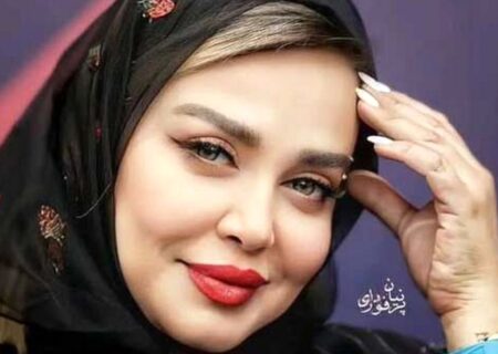 تفاوت فاحش  چهره بهاره رهنما قبل و بعد لاغری / معجزه را ببینید