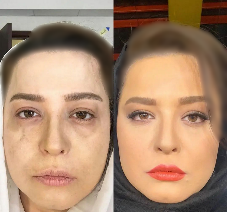 چهره فوق العاده سکسی مهراوه شریفی نیا قبل از آرایش / از لباس تا چهره کبود طبیعی!