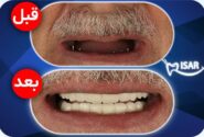 ورودی رسمی و روند شماره گذاری خودروهای موقت را در منطقه آزاد آروند شروع کنید