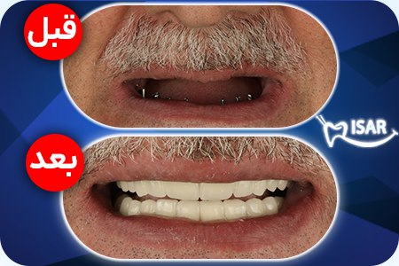ورودی رسمی و روند شماره گذاری خودروهای موقت را در منطقه آزاد آروند شروع کنید